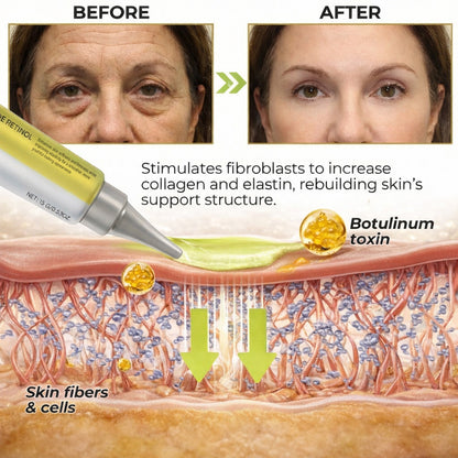 Get Botox-Level Tightening Without the Needle, Stroke Face, or 800 Maintenance!