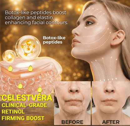 Get Botox-Level Tightening Without the Needle, Stroke Face, or 800 Maintenance!