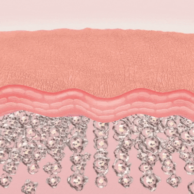 Get Botox-Level Tightening Without the Needle, Stroke Face, or 800 Maintenance!