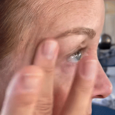 Get Botox-Level Tightening Without the Needle, Stroke Face, or 800 Maintenance!